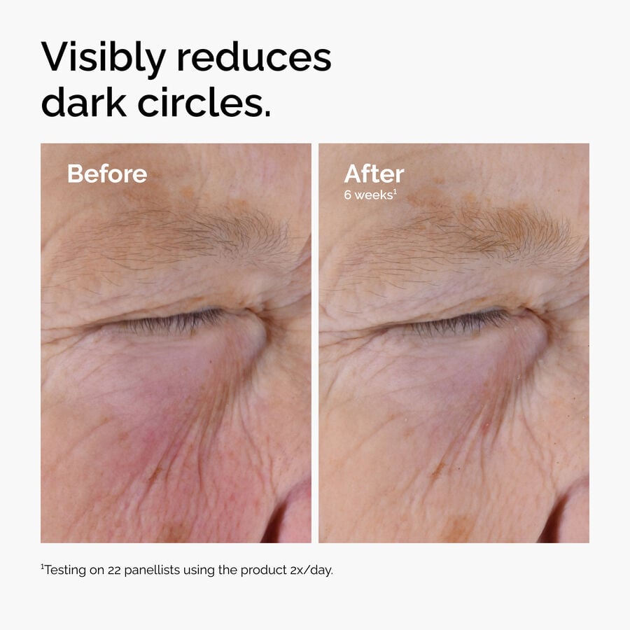 caffeine-solution-5-egcg-eye-serum-z3 ord-caffeine-solution-egcg-dark-circles-before-after.jpg