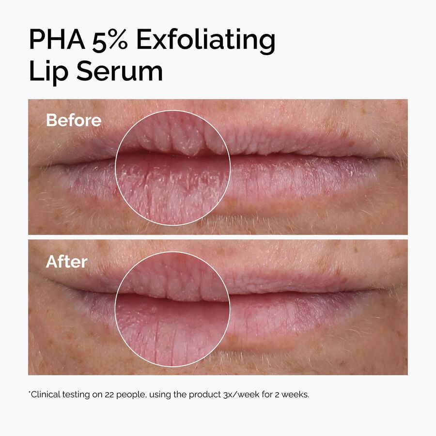 pha-5-exfoliating-lip-serum-p0 ord-pha-5pct-lip-exfoliating-serum-before-after.jpg