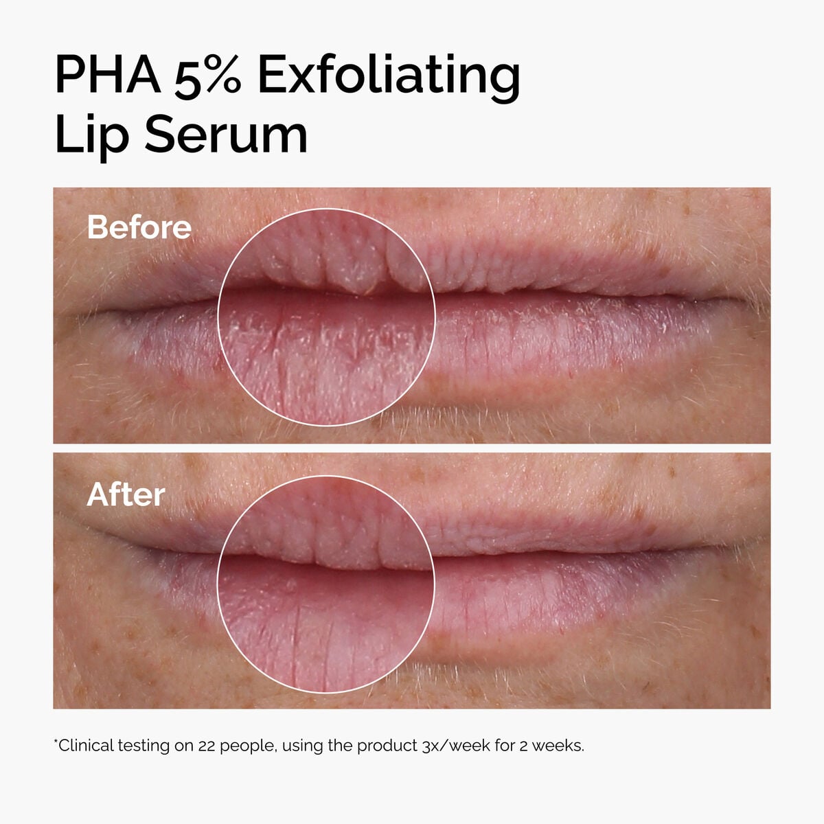 pha-5-exfoliating-lip-serum-p0 ord-pha-5pct-lip-exfoliating-serum-before-after.jpg