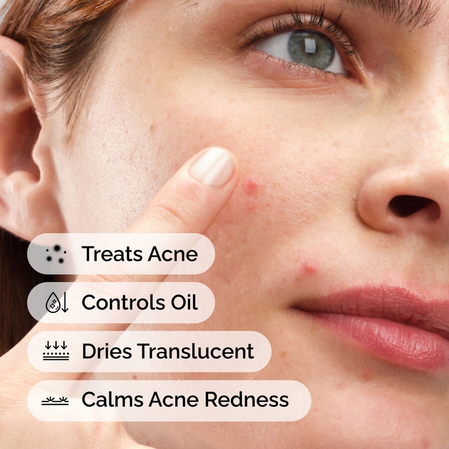 sulfur-10-powder-to-cream-concentrate-o3 ord-sulfur-10pct-powder-to-cream-concentrate-model-application-with-benefits-acne.jpg